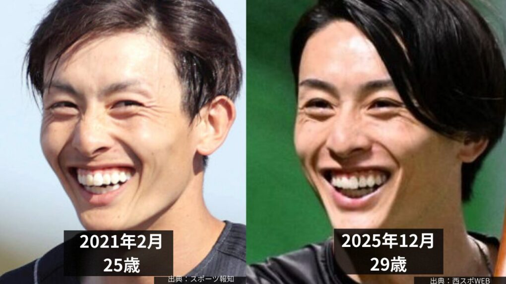 周東佑京選手の歯列矯正
昔と現在の比較画像