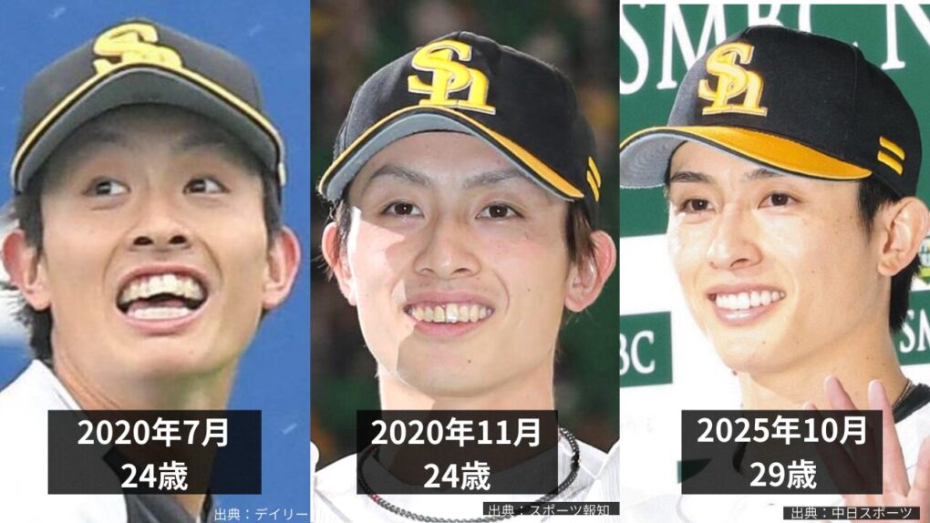 周東佑京選手が歯並びが良くなった時期はいつか比較画像